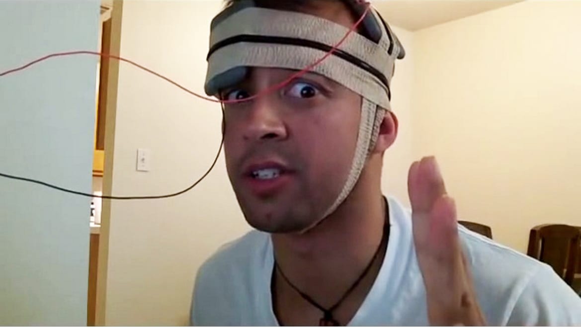 A man with electrodes on his brain