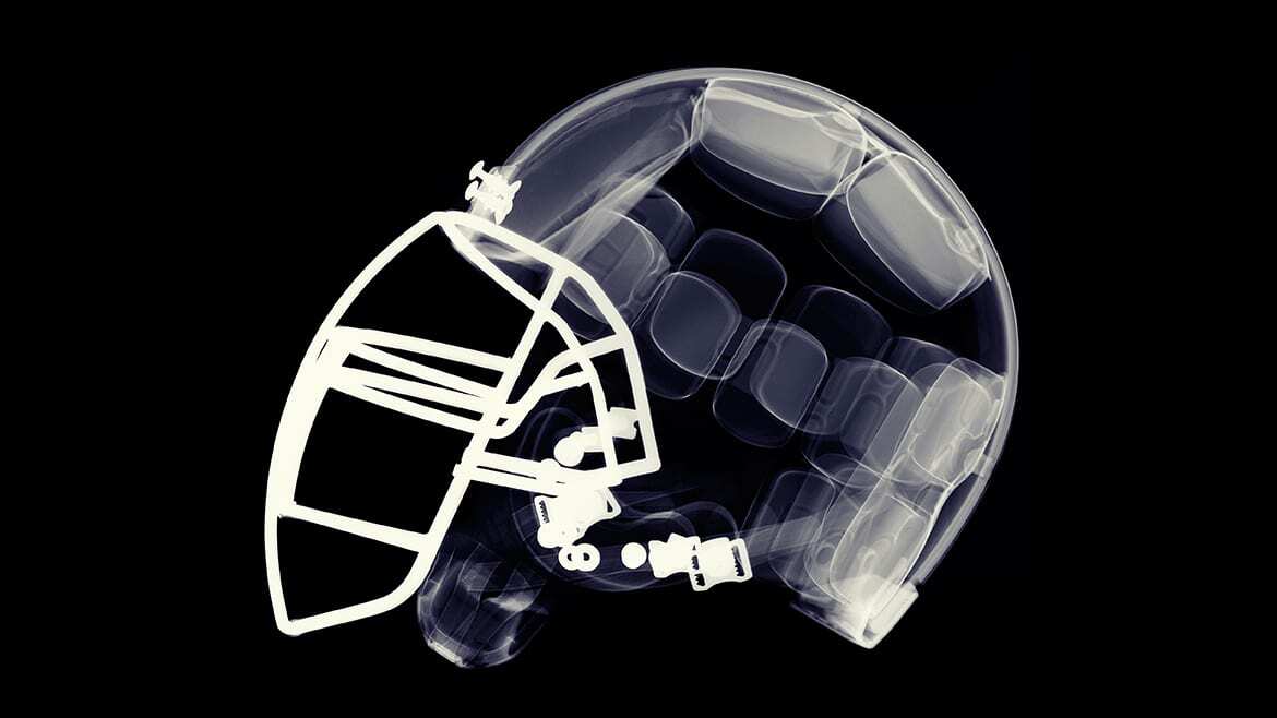 X-ray image of football helmet.