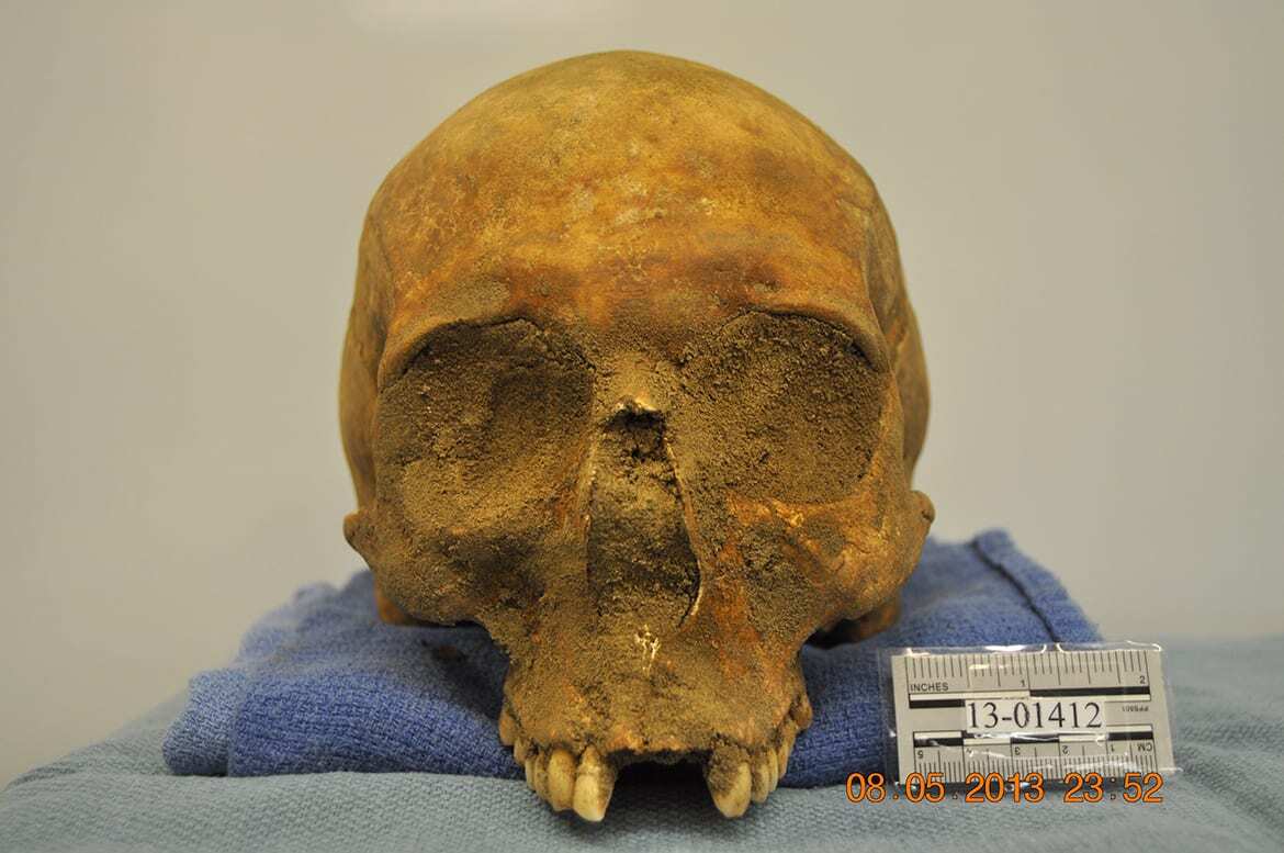 Skull